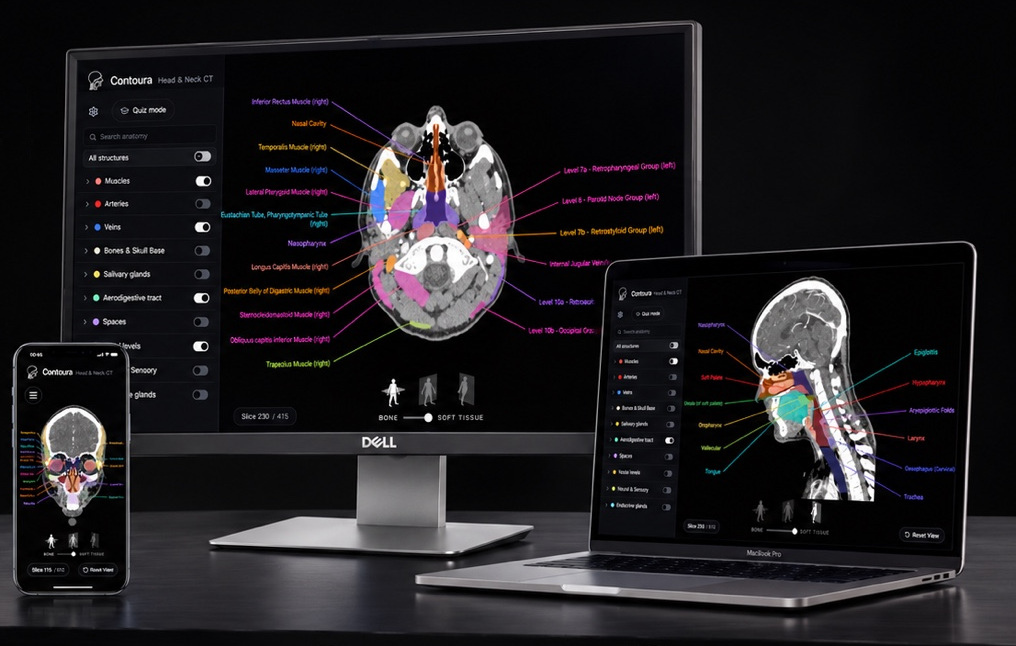 Contoura anatomy atlas displayed on Dell monitor, MacBook and iPhone, all on one desk